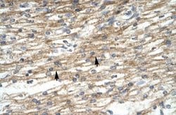 PREB Rabbit anti-Human, Polyclonal, Novus Biologicals 100 &mu;g; Unconjugated:Antibodies,